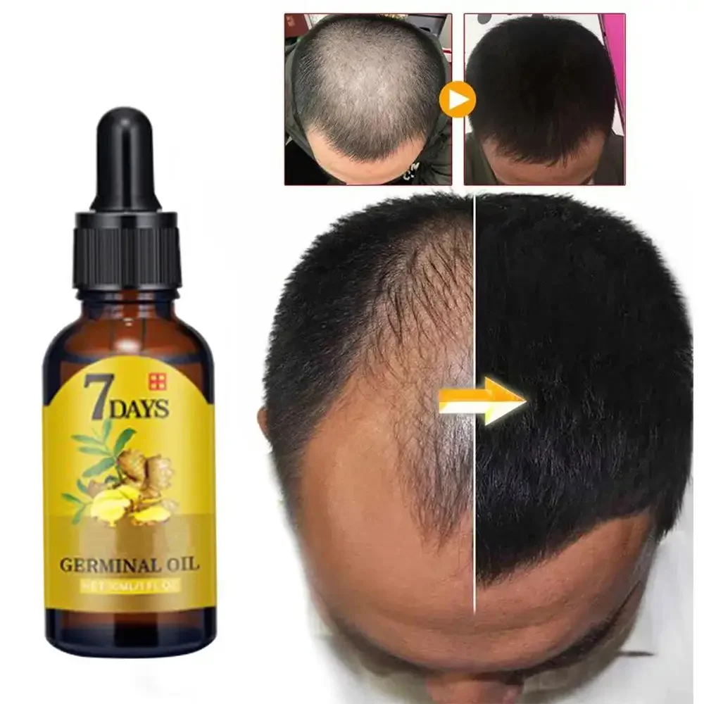 Ingrown Hair Serum - نمو الشعر الزنجبيل سريع النمو زيت