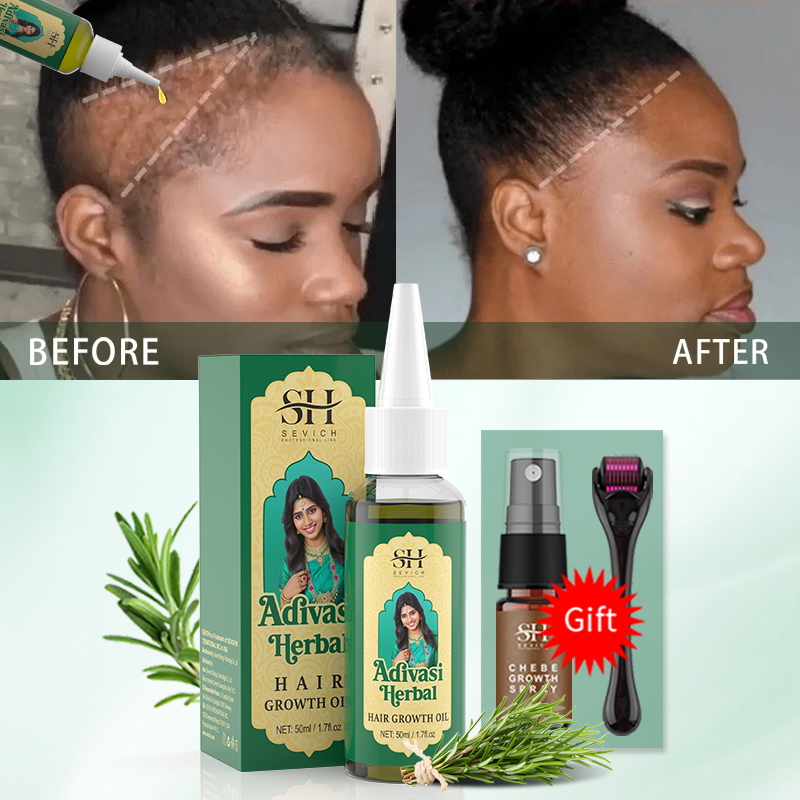 زيت نمو الشعر الأيورفيدي الهند - مراجعة Ingrown Hair Serum وسعره