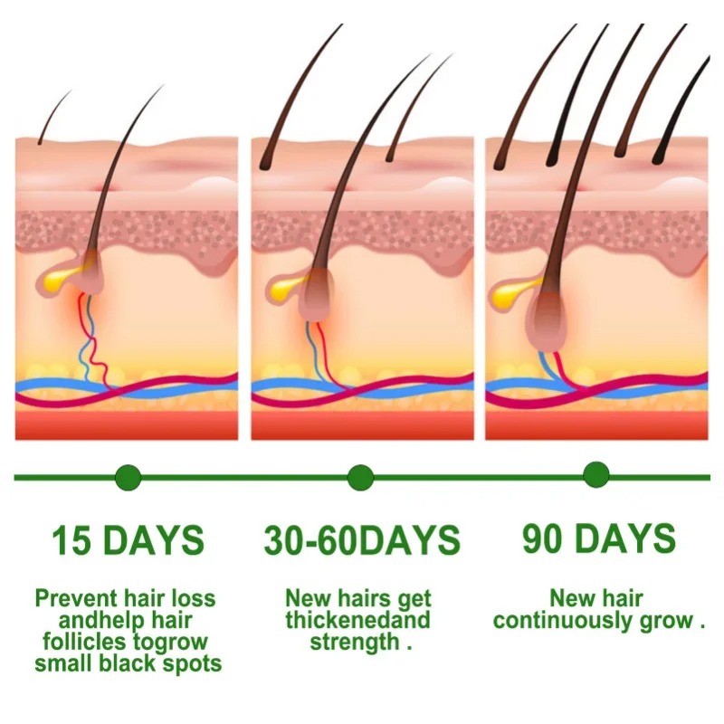 مصل نمو الشعر مجموعة العناية ب - مراجعة Ingrown Hair Serum وسعره