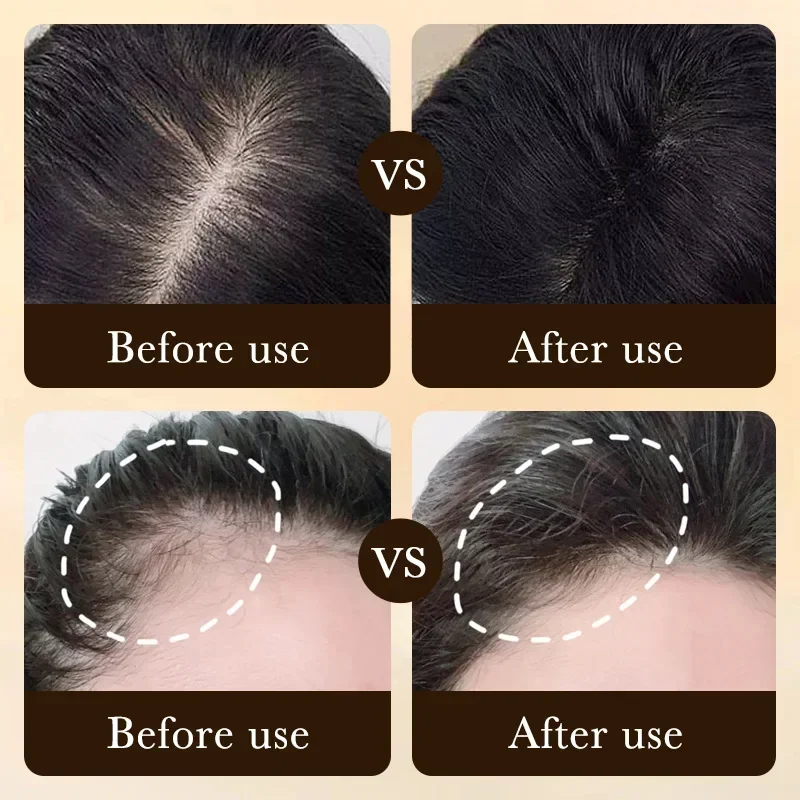 زيت البيوتين لنمو الشعر السريع - مراجعة Ingrown Hair Serum وسعره
