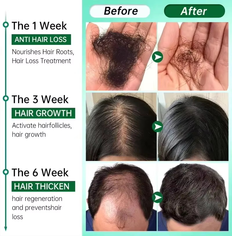 سيروم نمو الشعر، كبسولات أساسي - مراجعة Ingrown Hair Serum وسعره