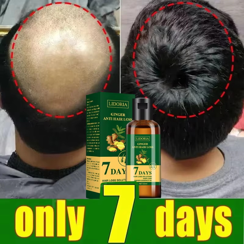 سيروم نمو الشعر، كبسولات أساسي - مراجعة Ingrown Hair Serum وسعره