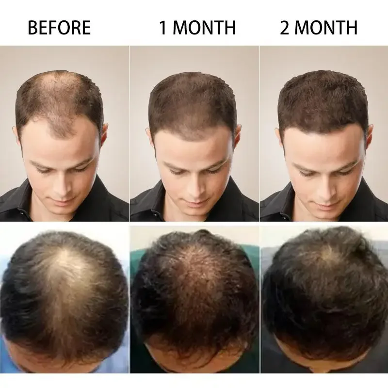 نمو الشعر الزنجبيل سريع النمو  - مراجعة Ingrown Hair Serum وسعره
